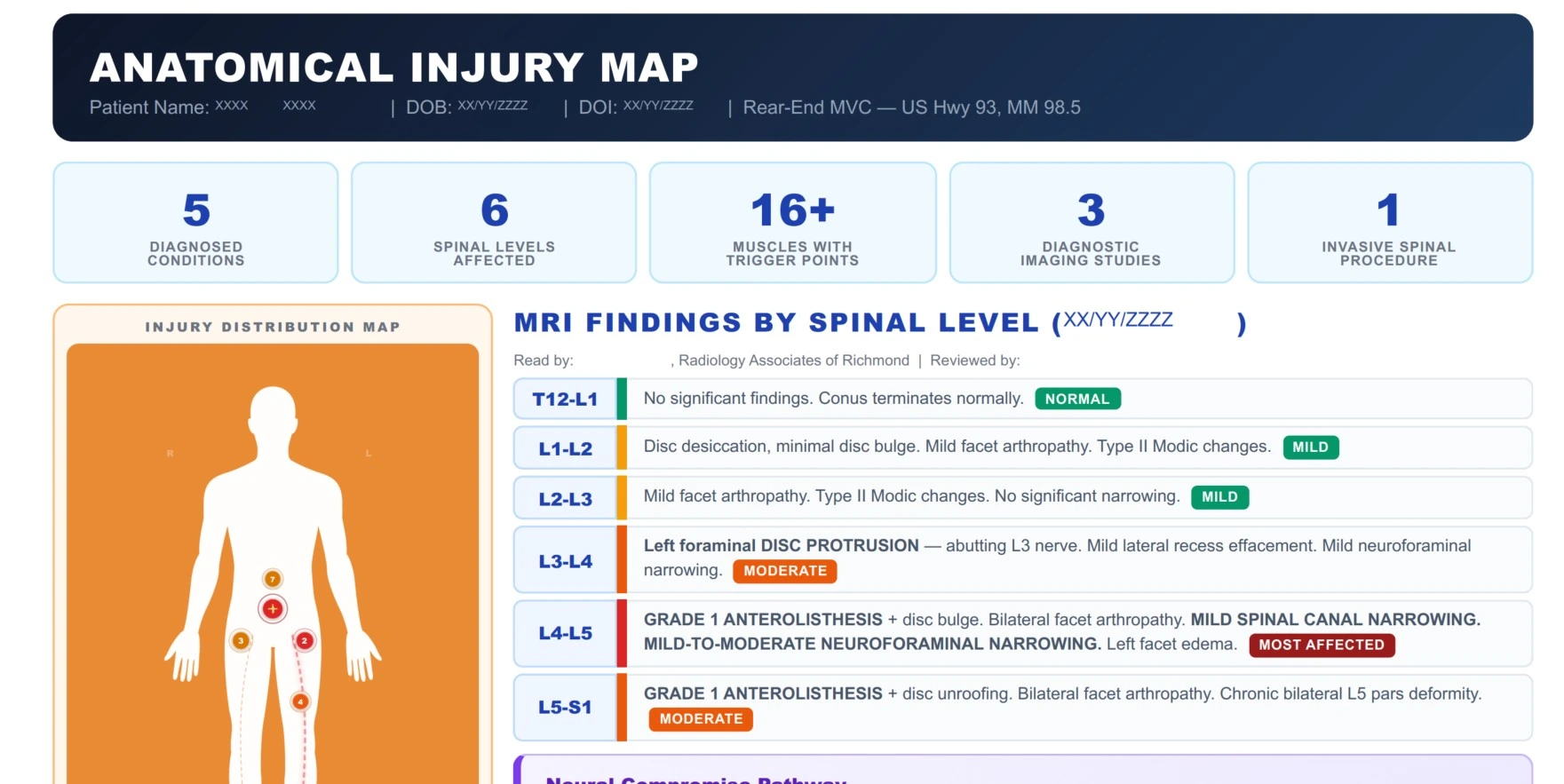Anatomical Injury Map